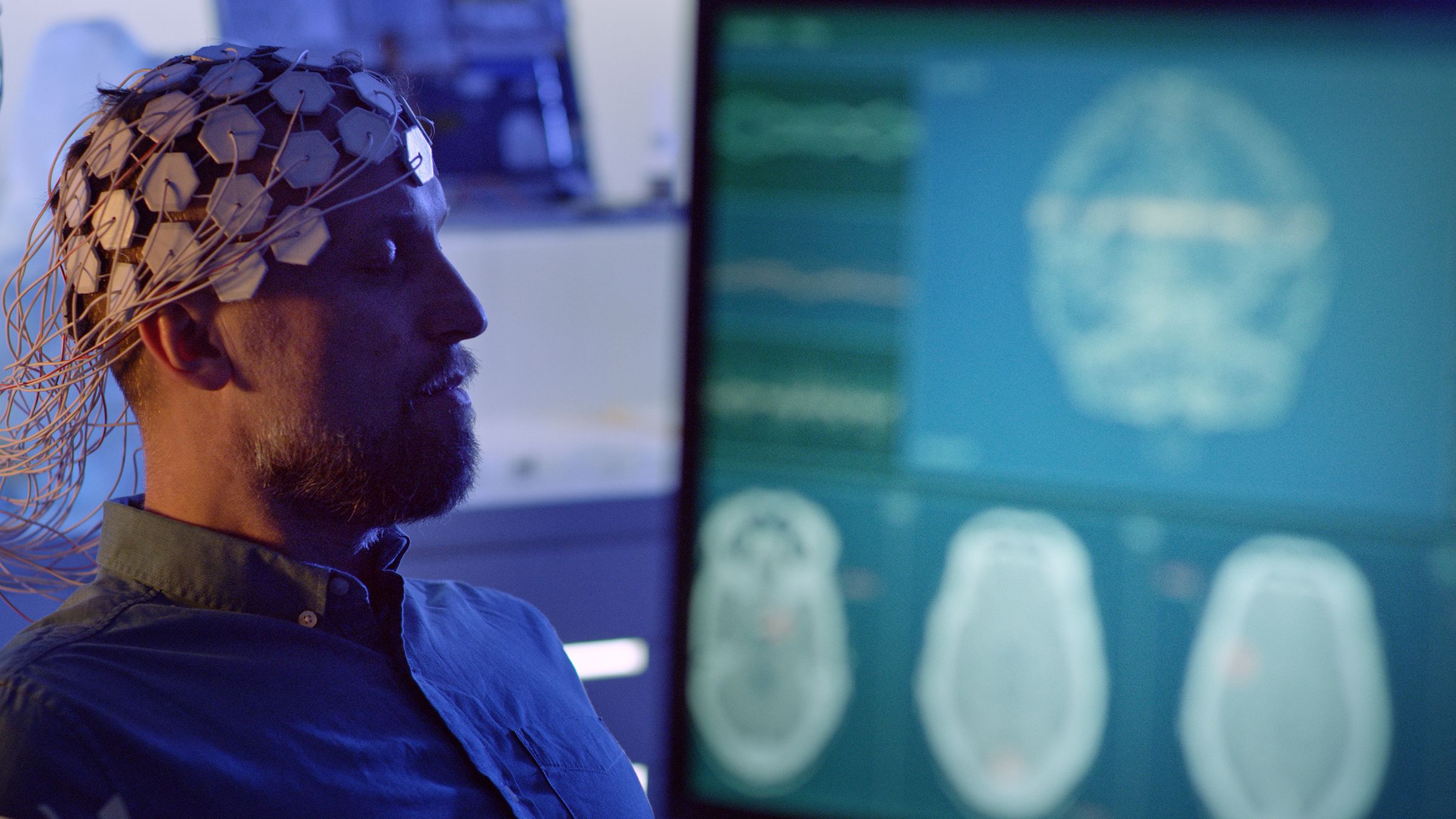 Cleveland Clinic Partners with Piramidal to Deploy AI Brain Monitoring in ICUs