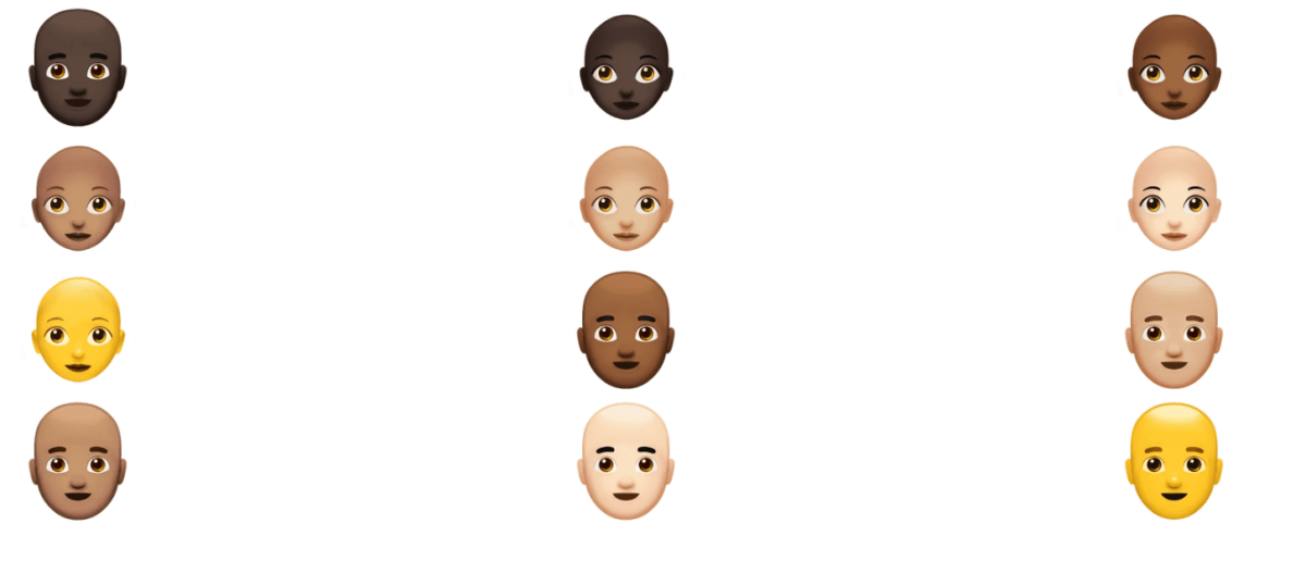 MyHair AI Launches AI-Powered Platform for Hair‑Loss Diagnosis and Care